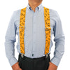 Ein Mann mit hellblauem Hemd und schwarzen Hosen mit leuchtend orangefarbenen elastischen Hosenträgern.