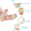 A beige stretchable fabric silicone pad designed to provide a perfect shape for the foot and improve air permeability.