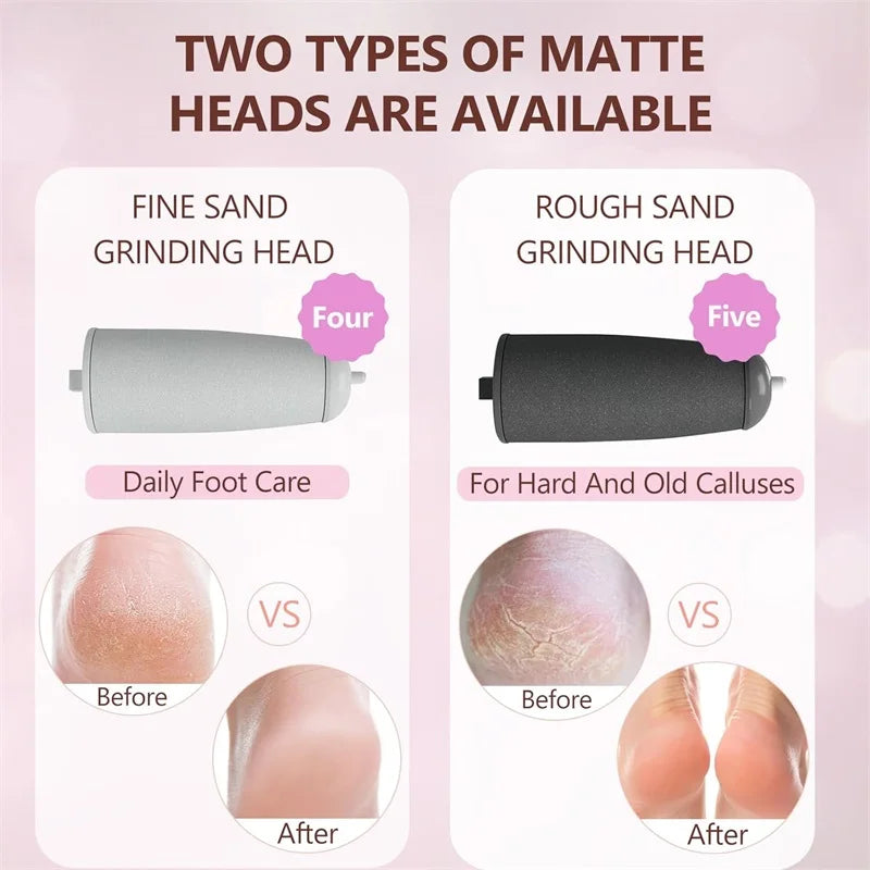 Zwei Arten von mattierten Schleifköpfen für Fußpflege: feiner und grober Sand.
